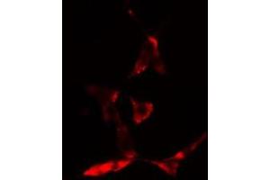 ABIN6275675 staining CoLo cells by IF/ICC. (NSF 抗体  (Internal Region))