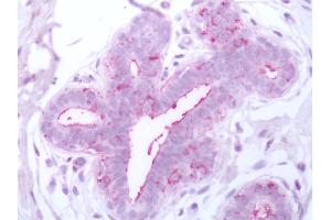 Human Breast: Formalin-Fixed, Paraffin-Embedded (FFPE) (BACE1 抗体  (N-Term))