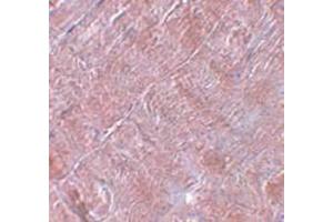 Immunohistochemistry staining in human skeletal muscle tissue with RANBP10 Antibody  at 5 μg/ml. (RANBP10 抗体  (Center))