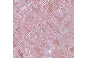 Immunohistochemistry staining in human skeletal muscle tissue with RANBP10 Antibody  at 5 μg/ml. (RANBP10 抗体  (Center))