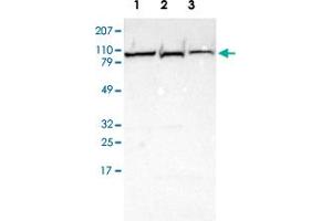 Western blot analysis of Lane 1: Human cell line RT-4 Lane 2: Human cell line EFO-21 Lane 3: Human cell line A-431 with PYGL polyclonal antibody  at 1:250-1:500 dilution.