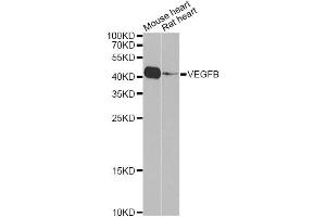 Western blot analysis of extracts of various cell lines, using VEGFB Antibody (ABIN5971159) at 1/1000 dilution.