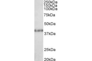 AP22371PU-N (1µg/ml) staining of Rat Kidney lysate (35µg protein in RIPA buffer).