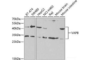 Western blot analysis of extracts of various cell lines using VAPB Polyclonal Antibody at dilution of 1:1000. (VAPB 抗体)