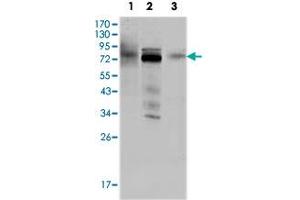 Western blot analysis using MDM4 monoclonal antobody, clone 2D10F4  against HeLa (1), A-549 (2) and A-431 (3) cell lysate. (MDM4-binding Protein 抗体)