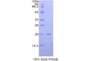 SDS-PAGE (SDS) image for Meningioma Expressed Antigen 5 (Hyaluronidase) (MGEA5) (AA 83-222) protein (His tag) (ABIN1877402)