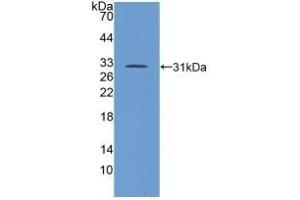 Detection of Recombinant TGFbR1, Human using Polyclonal Antibody to Transforming Growth Factor Beta Receptor I (TGFbR1) (TGFBR1 抗体  (AA 162-403))