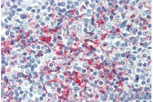 Human Spleen (formalin-fixed, paraffin-embedded) stained with GP1BB antibody ABIN396968 at 1:50 followed by biotinylated anti-mouse IgG secondary antibody ABIN481714, alkaline phosphatase-streptavidin and chromogen. (GP1BB 抗体)