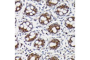 Immunohistochemistry of paraffin-embedded human colon using Monoamine Oxidase B (MAOB) Rabbit pAb (ABIN3022151, ABIN3022152, ABIN3022153, ABIN1513172 and ABIN6218632) at dilution of 1:150 (40x lens). (Monoamine Oxidase B 抗体  (AA 1-260))