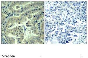 Image no. 1 for anti-Eukaryotic Translation Initiation Factor 4 Gamma, 1 (EIF4G1) (pSer1232) antibody (ABIN319277) (EIF4G1 抗体  (pSer1232))