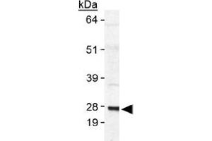 Western blot analysis of SAT1 in human SAT1 transfected lysate using with SAT1 polyclonal antibody . (SAT1 抗体  (AA 100-171))