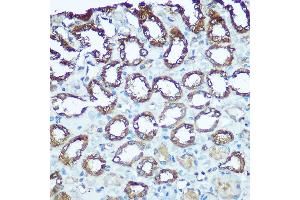 Immunohistochemistry of paraffin-embedded rat kidney using UQCRFS1 Rabbit pAb (ABIN6131106, ABIN6149963, ABIN6149965 and ABIN6222528) at dilution of 1:100 (40x lens). (UQCRFS1 抗体  (AA 79-274))