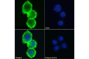 Immunofluorescence staining of RAW 264. (Recombinant Poliovirus Receptor 抗体)