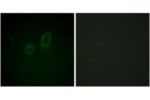 Immunofluorescence analysis of A549 cells, using Moesin/Ezrin/Radixin (Phospho-Thr558) Antibody. (Moesin/ezrin/radixin (AA 524-573), (pThr558) 抗体)