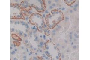 IHC-P analysis of Human Tissue, with DAB staining. (Trichohyalin 抗体  (AA 1851-1943))