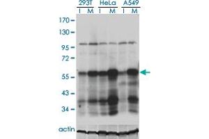 Western Blotting (WB) image for anti-Polo-Like Kinase 1 (PLK1) (AA 1-603) antibody (ABIN562276)