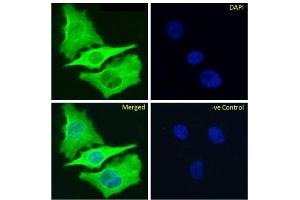 Immunofluoresence staining of fixed HeLa cells with anti-Beta-tubulin antibody S11B. (Recombinant TUBB 抗体)