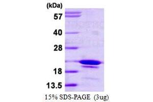 SDS-PAGE (SDS) image for SYF2 Homolog, RNA Splicing Factor (SYF2) (AA 94-243) protein (His tag) (ABIN6386826) (SYF2 Protein (AA 94-243) (His tag))