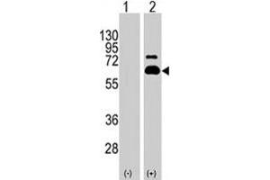 Western blot analysis of RPS6KB1 (arrow) using RPS6KB1 polyclonal antibody . (RPS6KB1 抗体  (Ser404))