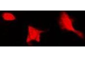 Immunofluorescent analysis of SEPHS1 staining in Hela cells.