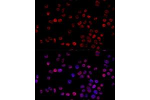 Immunofluorescence analysis of 293T cells using HNRNPH1 Polyclonal Antibody (ABIN6133752, ABIN6141911, ABIN6141912 and ABIN7101789) at dilution of 1:100 (40x lens).