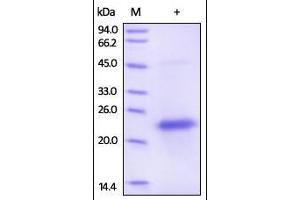 Human VEGF165 Protein, His Tag on SDS-PAGE under reducing (R) and no-reducing (NR) conditions. (VEGF Protein (AA 27-191) (His tag))