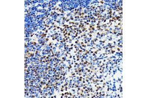 anti-Exportin 1 (XPO1) antibody