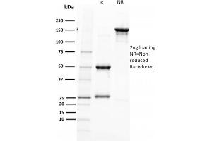 SDS-PAGE Analysis Purified PAX5 Mouse Monoclonal Antibody (PAX5/2595). (PAX5 抗体)