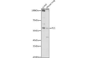 Western blot analysis of extracts of various cell lines, using (ABIN6129576, ABIN6140673, ABIN6140674 and ABIN6221283) at 1:1000 dilution. (FLI1 抗体  (AA 1-100))
