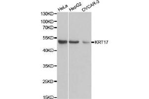 Western blot analysis of extracts of various cell lines, using KRT17 antibody. (KRT17 抗体  (AA 133-432))