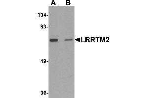 Western Blotting (WB) image for anti-Leucine Rich Repeat Transmembrane Neuronal 2 (LRRTM2) (C-Term) antibody (ABIN1030497) (LRRTM2 抗体  (C-Term))