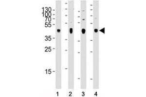 Western blot analysis of lysate from 1) human skeletal muscle, 2) human brain, 3) mouse brain, and 4) rat brain tissue using PDK2 antibody at 1:2000 for each lane. (PDK2 抗体)