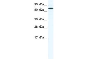 WB Suggested Anti-FOXO6 Antibody Titration:  1. (Foxo6 抗体  (N-Term))