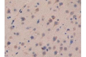 Detection of CDH16 in Mouse Brain Tissue using Polyclonal Antibody to Cadherin 16 (CDH16) (Cadherin-16 抗体  (AA 353-617))