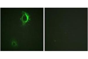 Immunofluorescence analysis of HepG2 cells, using CD5 (Phospho-Tyr453) Antibody. (CD5 抗体  (pTyr453))