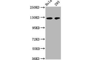 Western Blot Positive WB detected in: Hela whole cell lysate, 293 whole cell lysate All lanes: CD146 antibody at 1:500 Secondary Goat polyclonal to Mouse IgG at 1/50000 dilution Predicted band size: 72, 58 kDa Observed band size: 120 kDa (MCAM 抗体  (AA 50-646))