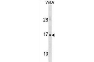 Western Blotting (WB) image for anti-Hemoglobin, zeta (HBZ) antibody (ABIN3001037) (HBZ 抗体)