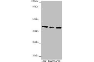 Western blot All lanes: DYNC2LI1 antibody at 1. (DYNC2LI1 抗体  (AA 1-352))
