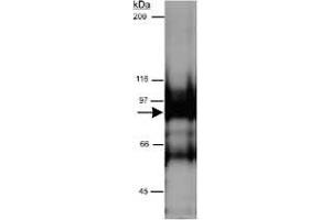 Western blot analysis of CYTSB in HeLa whole cell lysate (RIPA) using CYTSB polyclonal antibody  at 0. (NSP5 抗体  (AA 200-300))