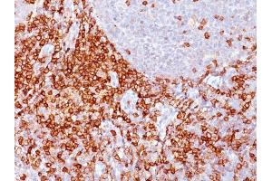 Formalin-fixed, paraffin-embedded human Spleen stained with CD43 Mouse Monoclonal Antibody (Bra7G). (CD43 抗体)