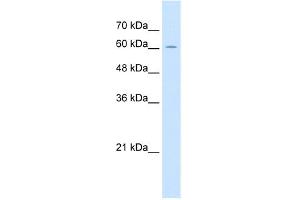 WB Suggested Anti-ZP2 Antibody Titration:  2. (ZP2 抗体  (C-Term))