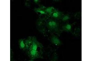 Anti-EIF4E2 mouse monoclonal antibody (ABIN2454229) immunofluorescent staining of COS7 cells transiently transfected by pCMV6-ENTRY EIF4E2 (RC201391). (EIF4E2 抗体)