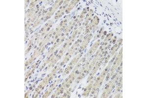 Immunohistochemistry of paraffin-embedded mouse stomach using FANCL antibody at dilution of 1:100 (x40 lens).