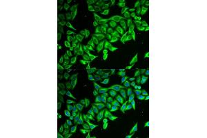 Immunofluorescence analysis of MCF-7 cells using DAP antibody (ABIN6130322, ABIN6139397, ABIN6139398 and ABIN6221757). (DAP 抗体  (AA 1-102))