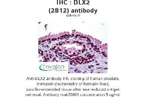 Image no. 1 for anti-Distal-Less Homeobox Protein 2 (DLX2) (AA 1-110) antibody (ABIN1723650) (DLX2 抗体  (AA 1-110))