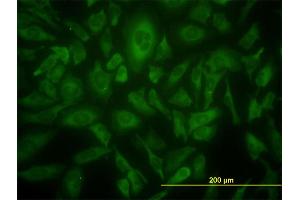 Immunofluorescence of monoclonal antibody to USP9X on HeLa cell. (USP9X 抗体  (AA 1-90))