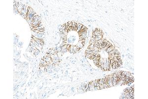 Immunohistochemistry (IHC) image for anti-alpha 1 Sodium Potassium Atpase antibody (ABIN7455086) (alpha 1 Sodium Potassium Atpase 抗体)