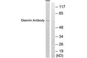 Western blot analysis of extracts from K562 cells, using Desmin Antibody.