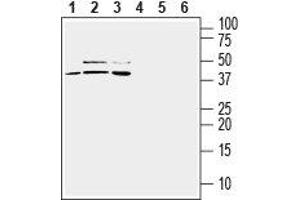 Western blot analysis of mouse BV-2 microglia (lanes 1 and 4), human U-87 MG glioblastoma (lanes 2 and 5) and human THP-1 monocytic leukemia (lanes 3 and 6) cell line lysates: - 1-3. (TREM2 抗体  (Extracellular, N-Term))