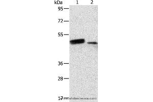 Western blot analysis of Human liver cancer and normal liver tissue, using RARB Polyclonal Antibody at dilution of 1:500 (Retinoic Acid Receptor beta 抗体)